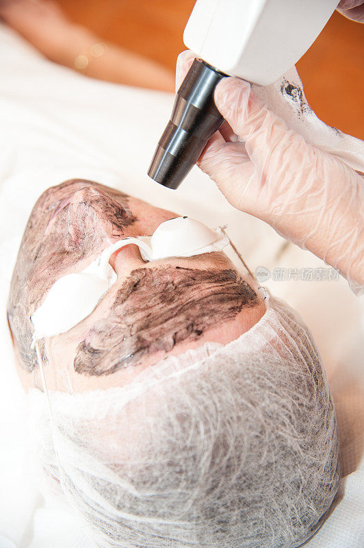 碳激光治疗皮肤/激光治疗